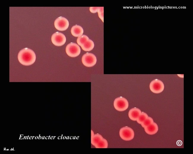 Enterobacter cloacae on Endo